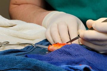 George, a 10-year-old Goldfish, Underwent a 45-minute Operation to Remove a Life-threatening Tumor at Lort Smith Animal Hospital in Melbourne, Australia, Last Week. George's Owners Were Reportedly Very Attached To…